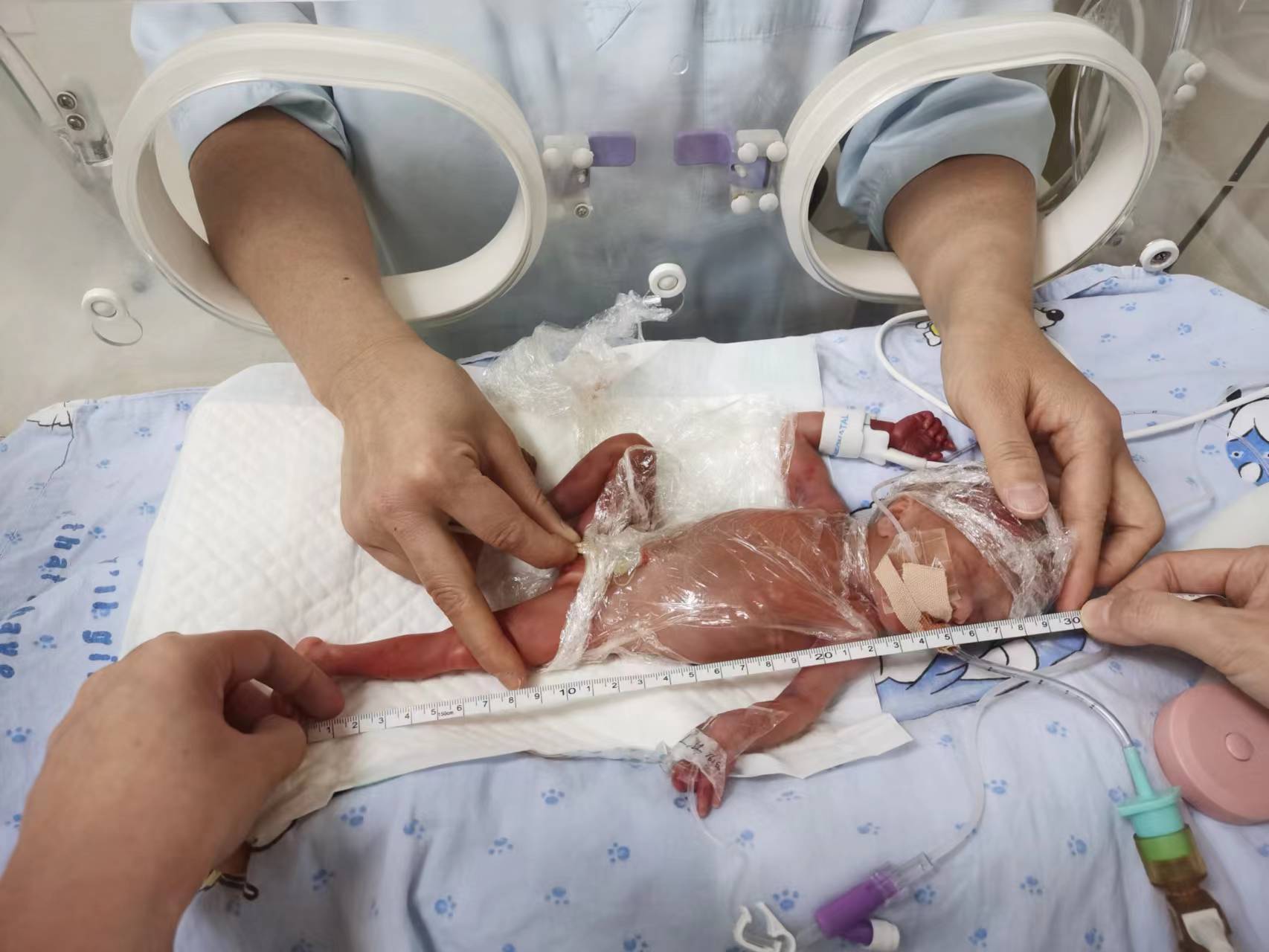 超極低體重兒.jpg 超極低體重兒.jpg