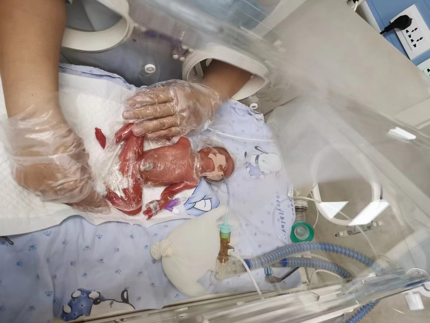 呼吸機(jī)1.jpg 呼吸機(jī)1.jpg