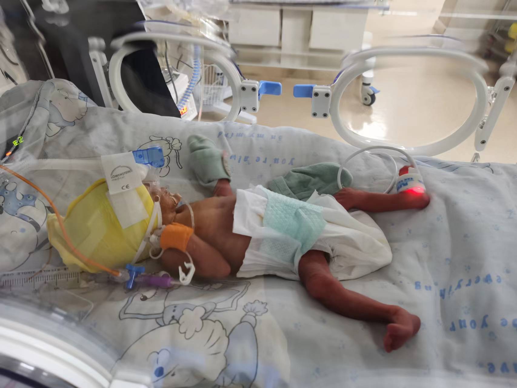 無創(chuàng)呼吸機(jī).jpg 無創(chuàng)呼吸機(jī).jpg