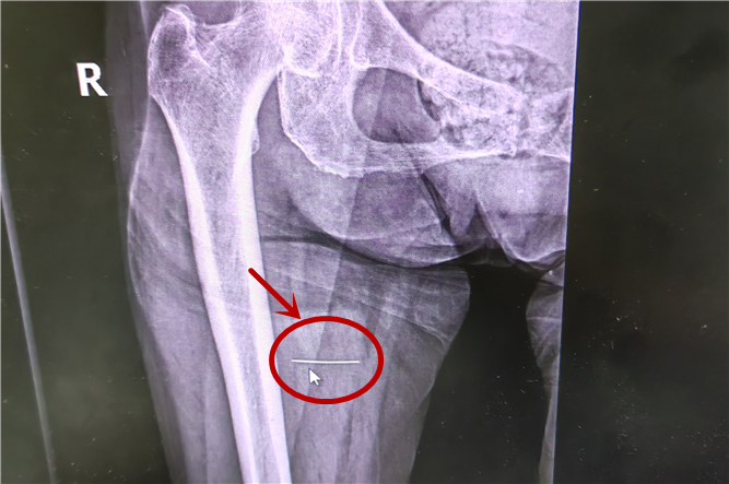 微信圖片_20241202104015_副本.jpg 微信圖片_20241202104015_副本.jpg